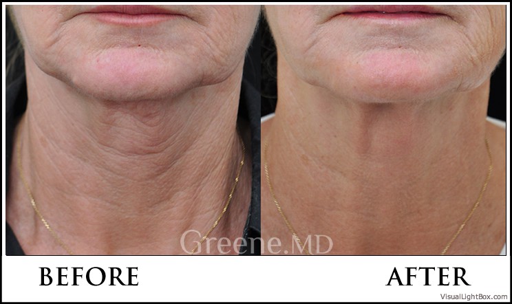 before_after_image_combined