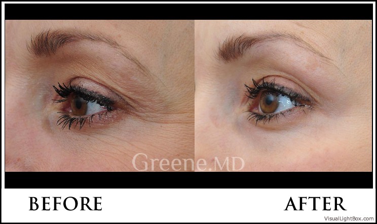 before_after_image_combined