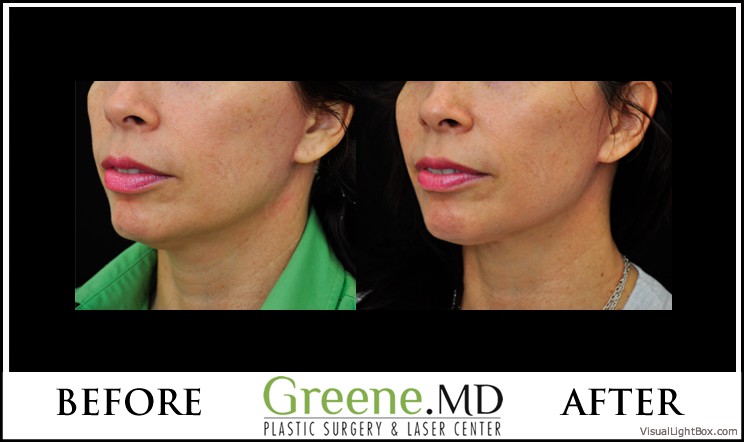 before_after_image_combined
