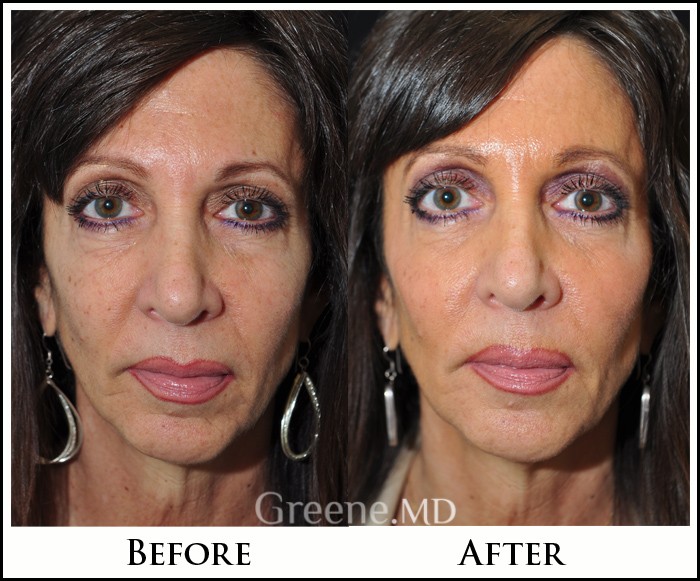 before_after_image_combined