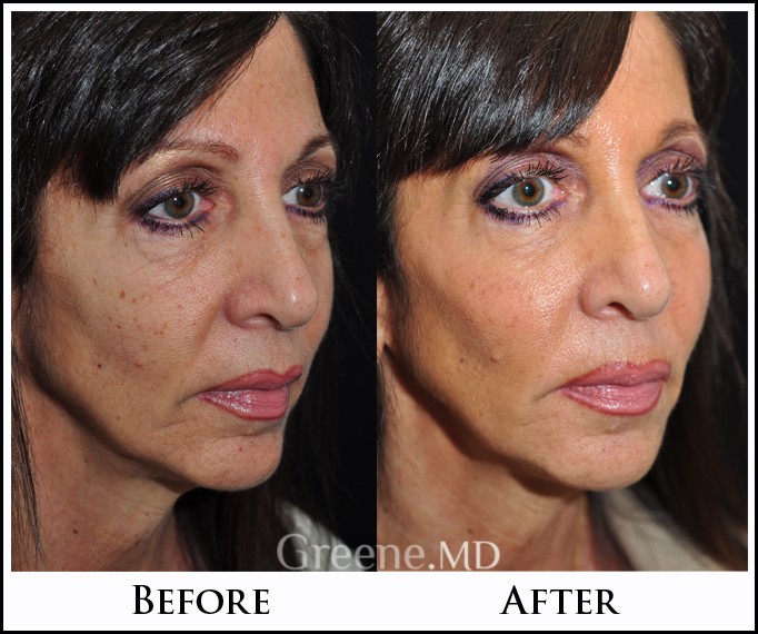 before_after_image_combined