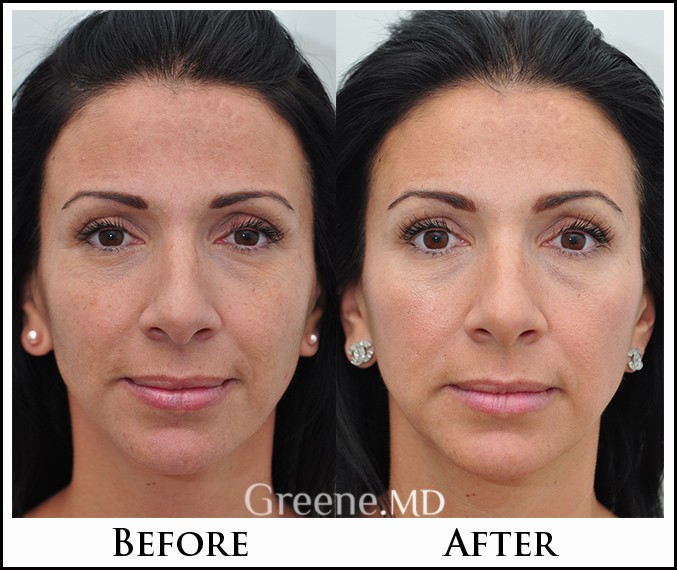before_after_image_combined