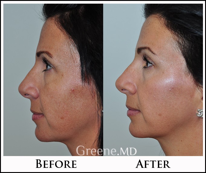 before_after_image_combined