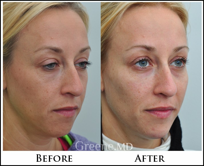 before_after_image_combined