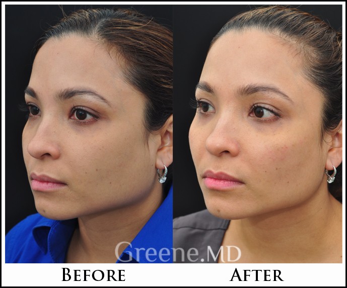 before_after_image_combined