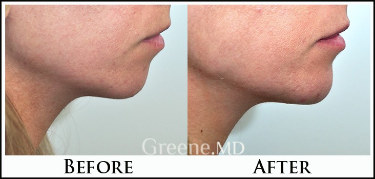 before_after_image_combined