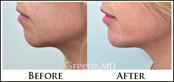 before_after_image_combined