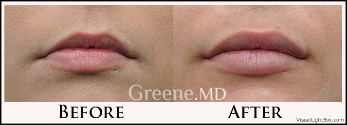 before_after_image_combined