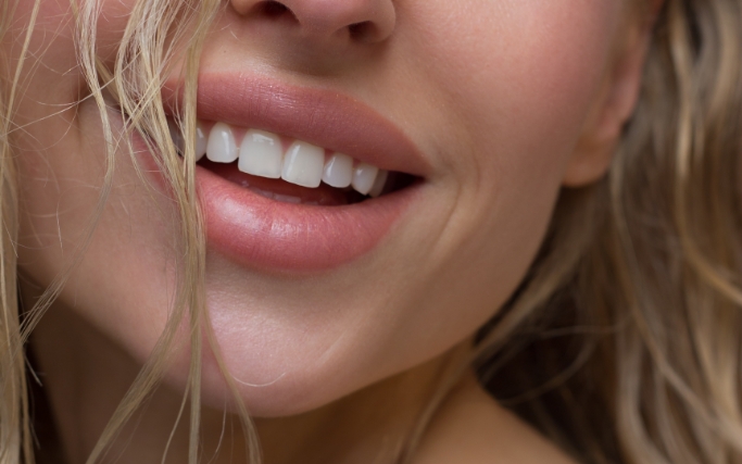FACIAL FILLERS