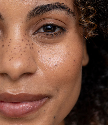 Filler Injections: How Long Does Swelling Last?